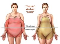 Bụng bia: nguy hiểm